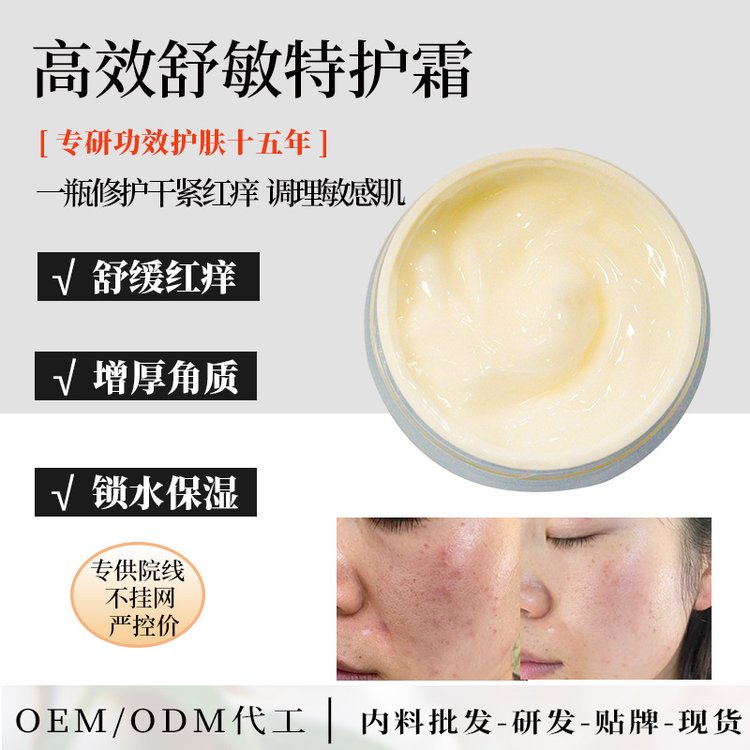 美容院增厚角质层敏感肌激素脸修护霜退红面霜药醇舒缓修护膏加工