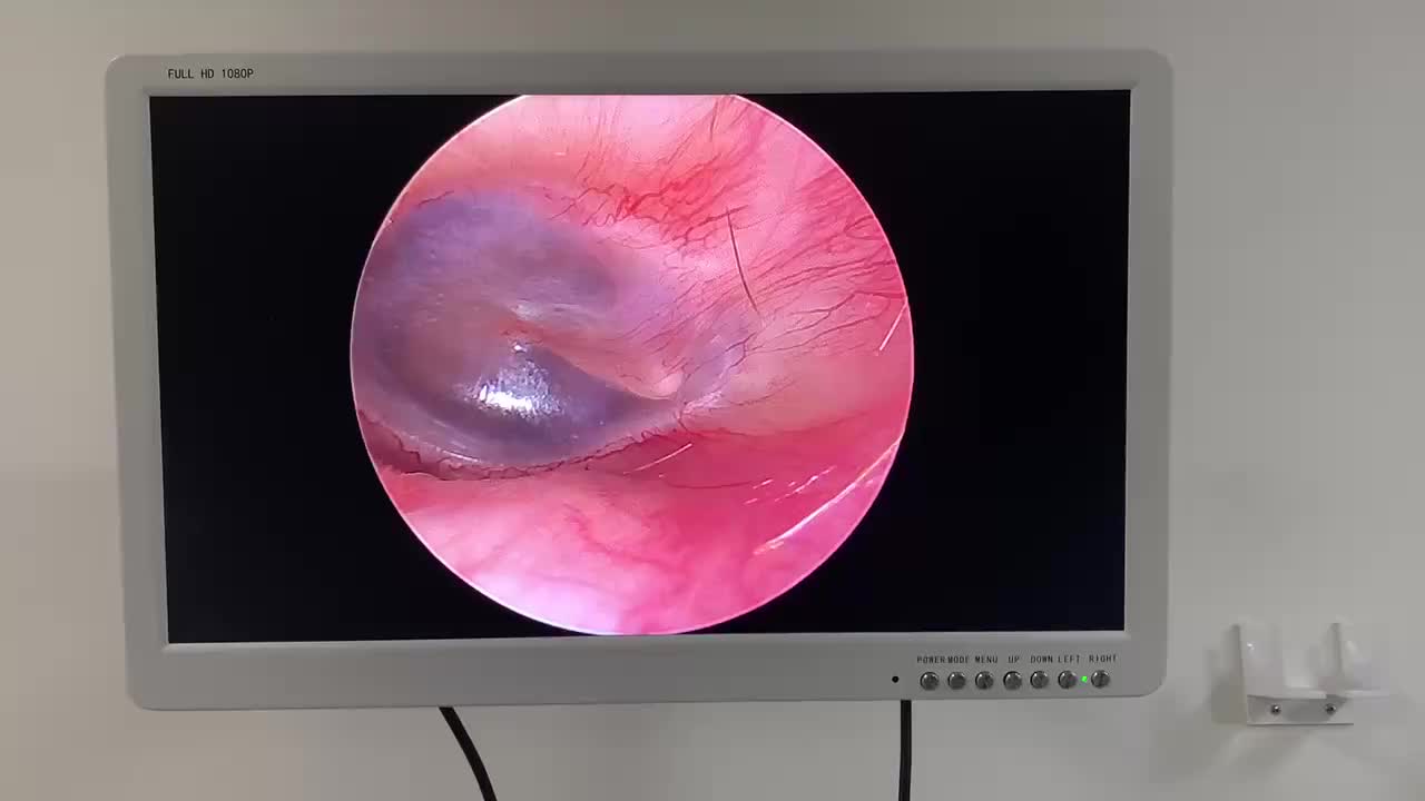 视频