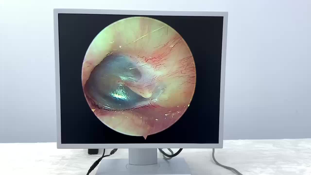 视频