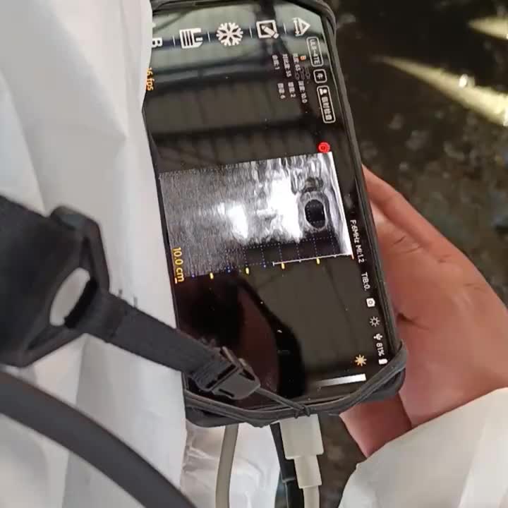 视频