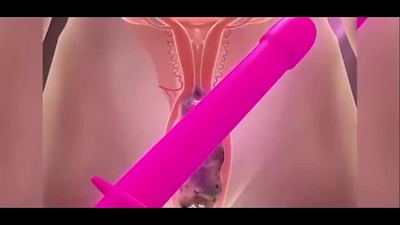 视频