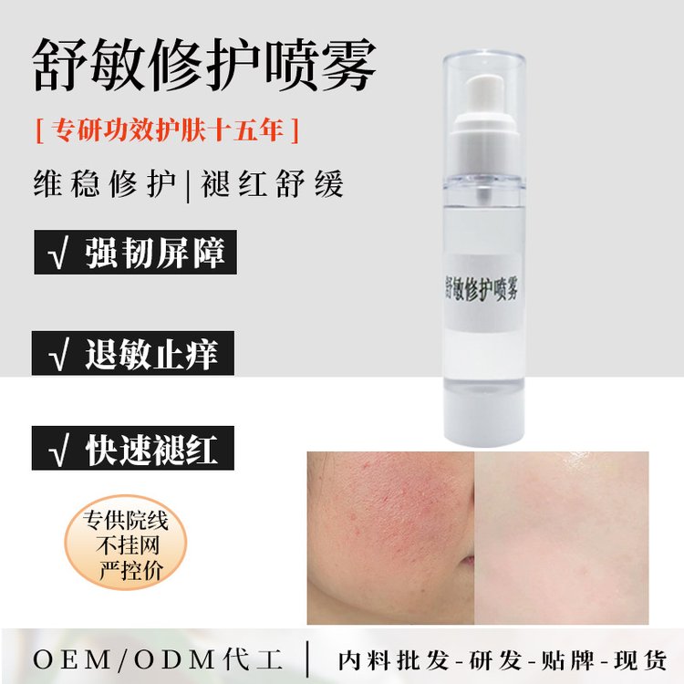 激素脸红血丝退红敏敏肌舒缓喷雾收缩毛孔稳固屏障精华喷雾加工