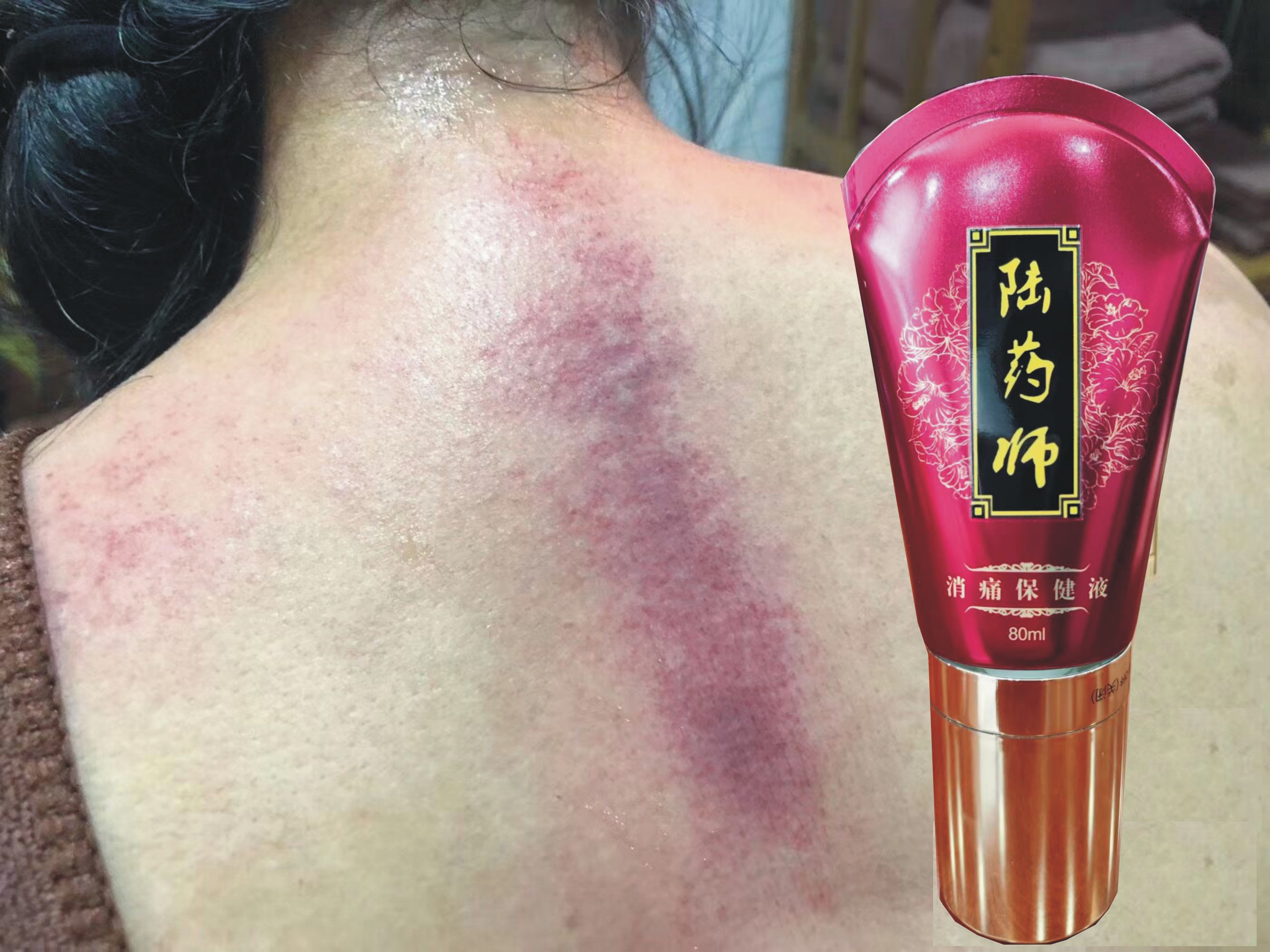 陆药师消痛保健液 疼痛液 万医堂凝胶推拿店颈肩护理刮痧