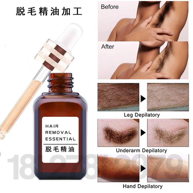 脱毛精油加工 温和除腿毛手毛腋下全身脱毛精油oem